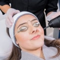 Laser Treatments for Skin Rejuvenation: An Overview